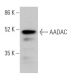 AADAC Antibody (G-12) - Western Blotting - Image 370148