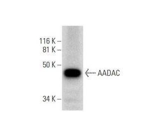 AADAC Antibody (H-8) - Western Blotting - Image 289593 