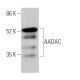 AADAC Antibody (H-8) - Western Blotting - Image 370149 