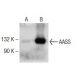 AASS Antibody (B-7) - Western Blotting - Image 141271