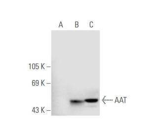 AAT Antibody (8.F.14) - Western Blotting - Image 56822
