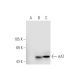 AAT Antibody (8.F.14) - Western Blotting - Image 56822