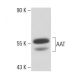 AAT Antibody (B9) - Western Blotting - Image 17122 