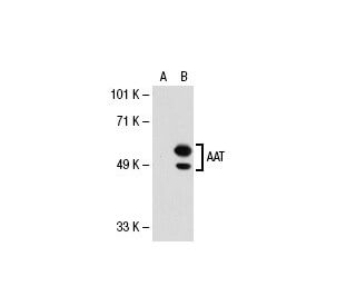 LINK AS-TRACK 2943060 - Caterpillar | AVSpare.com