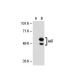 AAT Antibody (B9) - Western Blotting - Image 21111