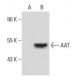 AAT Antibody (B9) - Western Blotting - Image 31830 