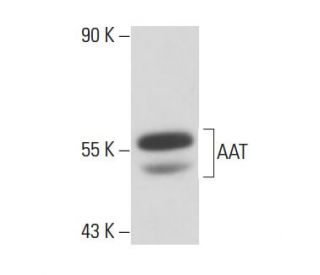 AAT Antibody (B9) - Western Blotting - Image 17122