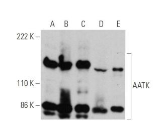 AATK Antibody (L-37) - Western Blotting - Image 384549 