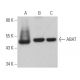 ABAT Antibody (B-12) - Western Blotting - Image 366714 