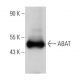 ABAT Antibody (B-12) - Western Blotting - Image 366716