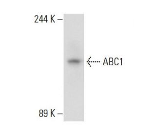 ABC1 Antibody (AB.H10) - Western Blotting - Image 108981The Double Nickase Plasmid features a U6 promoter for sgRNA expression, a 20 nt targeting sequence, and a gRNA scaffold to guide Cas9n. It includes a CBh promoter for Cas9n (D10A) and puromycin resistance, GFP for transfection verification, and nuclear localization signals (NLS). The 2A peptide allows co-expression of Cas9n and Puro from a single promoter, enabling precise genome editing with reduced off-target effects.