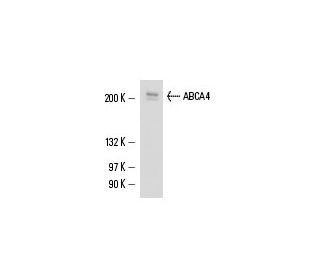 ABCA4 Antibody (3F4) - Western Blotting - Image 15736