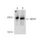ABCA7 Antibody (E-11) - Western Blotting - Image 283606