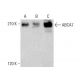 ABCA7 Antibody (E-11) - Western Blotting - Image 382839 