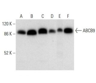 ABCB9 Antibody (E-2) - Western Blotting - Image 305711 