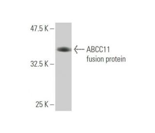 ABCC11 Antibody (4H6) - Western Blotting - Image 350315