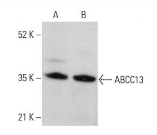 ABCC13 Antibody (B-2) - Western Blotting - Image 375544 