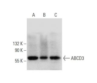 ＡＢＣＤ… [CD] Amazon.com: Zebra 800033-801 Black Monochrome Ribbon for ZXP