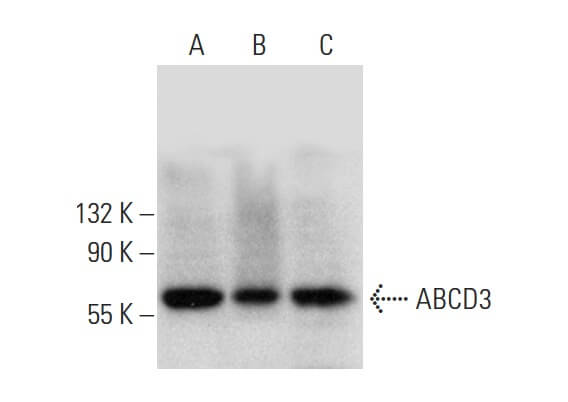 sabp様 ABCD3 Antibody (F-1) | SCBT - Santa Cruz Biotechnology