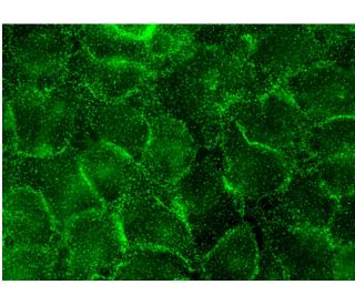 ABCG2 Antibody (5D3) - Immunofluorescence - Image 145130 