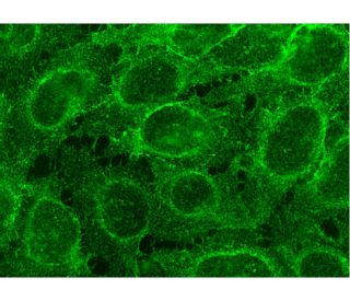ABCG2 Antibody (6D171) - Immunofluorescence - Image 145142 