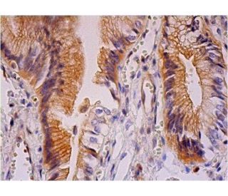 immunohistochemistry image from recommended ABCG2 (B-1) monoclonal antibody replacement. Image 293361
