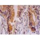 Este anticuerpo policlonal ha dejado de fabricarse. Consulta nuestro anticuerpo monoclonal recomendado <a href="abcg2-antibody-b-1">ABCG2 (B-1)</a> (se muestran datos de muestra). immunohistochemistry image from recommended ABCG2 (B-1) monoclonal antibody replacement. Image 293361