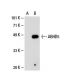 ABHD5 Antibody (36A) - Western Blotting - Image 19696