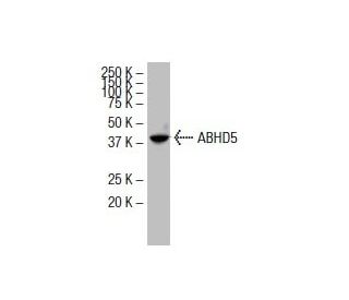 ABHD5 Antibody (36A) - Western Blotting - Image 33840 