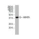 ABHD5 Antibody (36A) - Western Blotting - Image 33840 