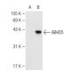 ABHD5 Antibody (36A) - Western Blotting - Image 82338 