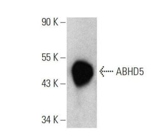 ABHD5 Antibody (C-8) - Western Blotting - Image 358567 