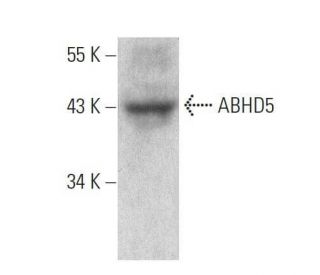 ABHD5 Antibody (C-9) - Western Blotting - Image 358566 