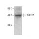 ABHD5 Antibody (C-9) - Western Blotting - Image 358566 