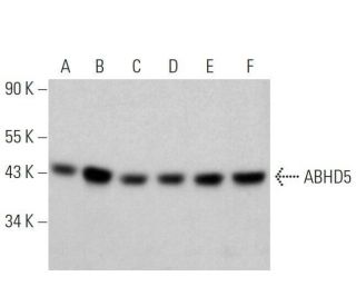 ABHD5 Antibody (E-1) - Western Blotting - Image 358565 