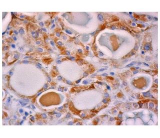 Abi-2 Antibody (B-8) - Immunohistochemistry - Image 285720 