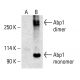 ABP1 Antibody (G-11) - Western Blotting - Image 413083