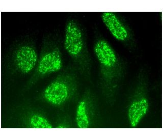 ABT1 Antibody (B-9) - Immunofluorescence - Image 296343 