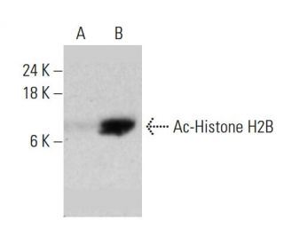 western blotting image from recommended Ac-Histone H2B (E-6) monoclonal antibody replacement. Image 383039