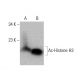 western blotting image from recommended Ac-Histone H3 (D-4) monoclonal antibody replacement. Image 385352