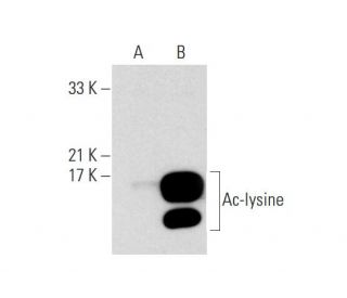 Ac-lysine Antibody (AKL5C1) - Western Blotting - Image 139610 