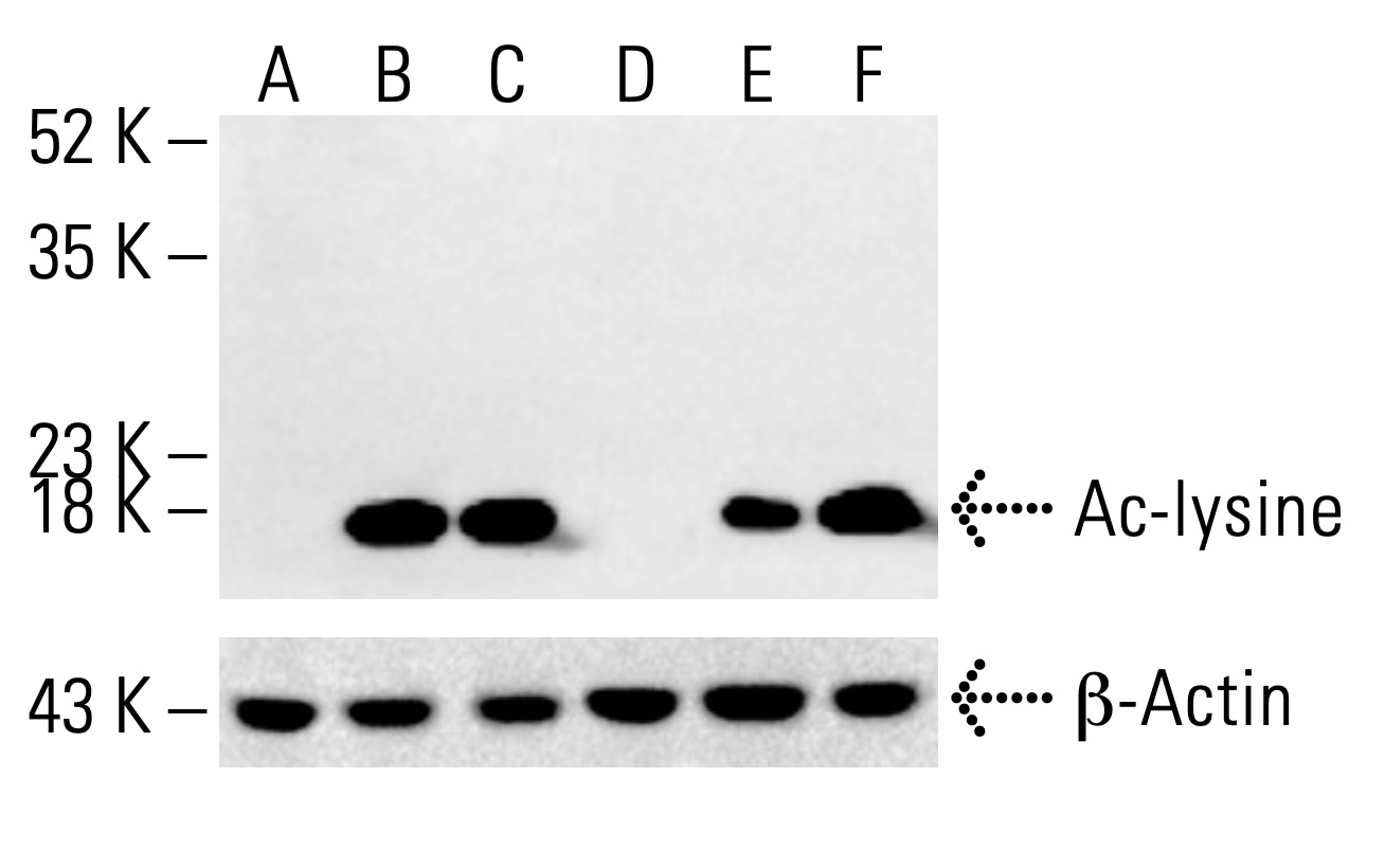 Ac-lysine Antibody (AKL5C1) | SCBT - Santa Cruz Biotechnology