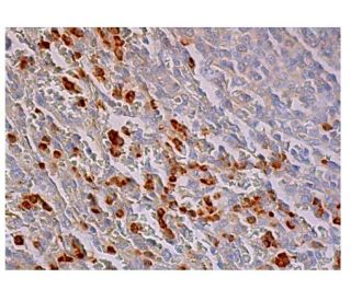 Ac-MMP9 Antibody (4A3) - Immunohistochemistry - Image 348947