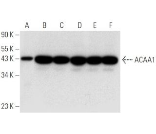 ACAA1 Antibody (C-8) - Western Blotting - Image 314186 