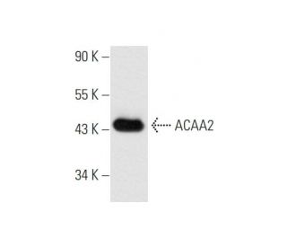 ACAA2 Antibody (192) - Western Blotting - Image 66979 