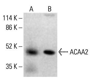 ACAA2 Antibody (192) - Western Blotting - Image 412749