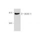 ACAD-11 Antibody (B-12) - Western Blotting - Image 319304 