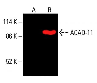 ACAD-11 Antibody (B-12) - Western Blotting - Image 416305