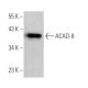 ACAD-8 Antibody (D-5) - Western Blotting - Image 369404