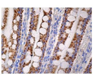 ACADS Antibody (B-8) - Immunohistochemistry - Image 161087 